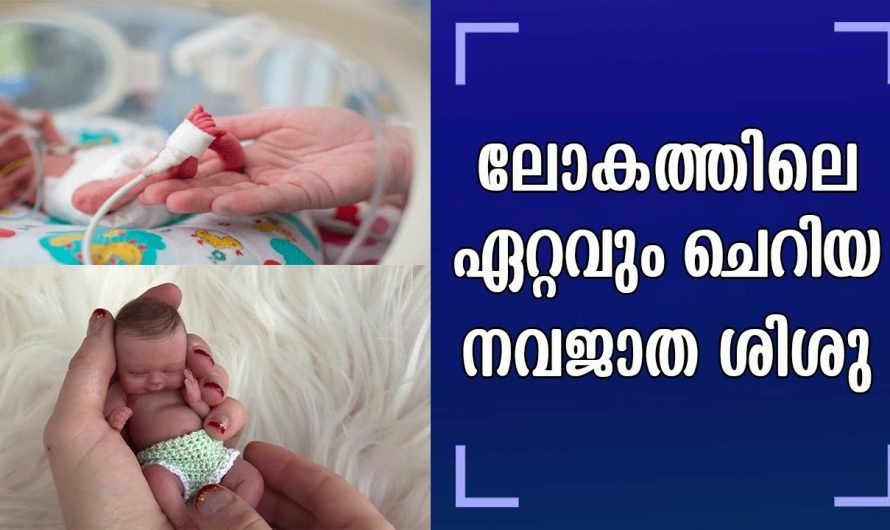 മാസം തികയാതെ പുറത്തേക്ക് വന്ന ആ കുഞ്ഞിന്റെ ഇപ്പോഴത്തെ അവസ്ഥ