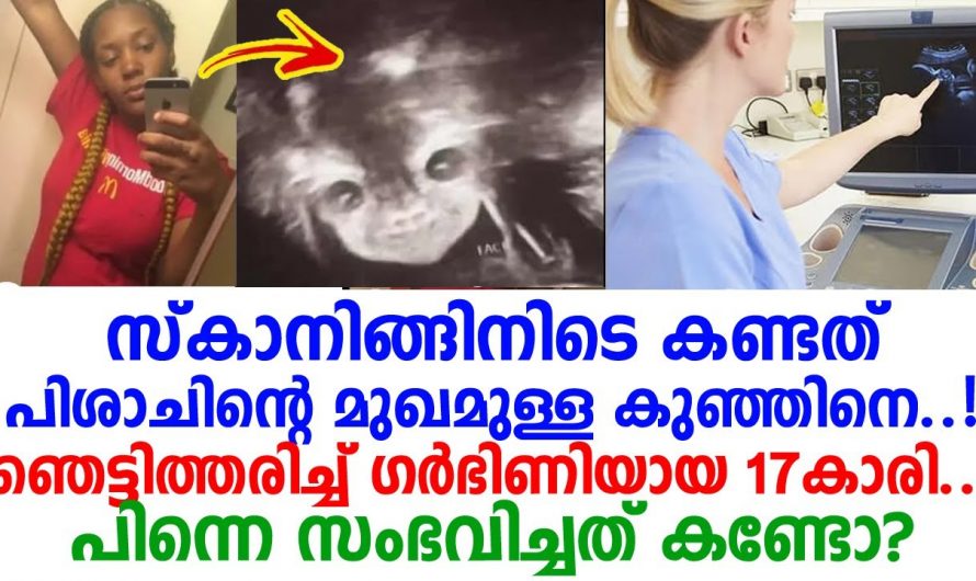 17 കാരിയായ യുവതി തന്റെ കുഞ്ഞിനെ സ്കാനിങ് വഴി കാണാൻ കൊതിയായി പോയതാണ് പക്ഷേ കണ്ടത് പിശാചിന്റെ മുഖം