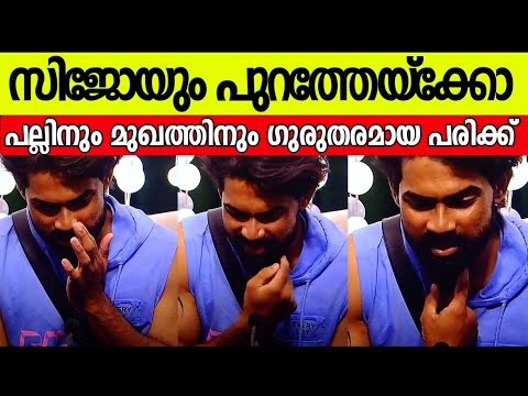 സിജോയും ബിഗ് ബോസ് ഹൗസിന് പുറത്തേക്ക്. അപ്രതീക്ഷിത സംഭവങ്ങളിലൂടെ മുഖത്തും പല്ലിനും ഗുരുതര പരിക്ക്.