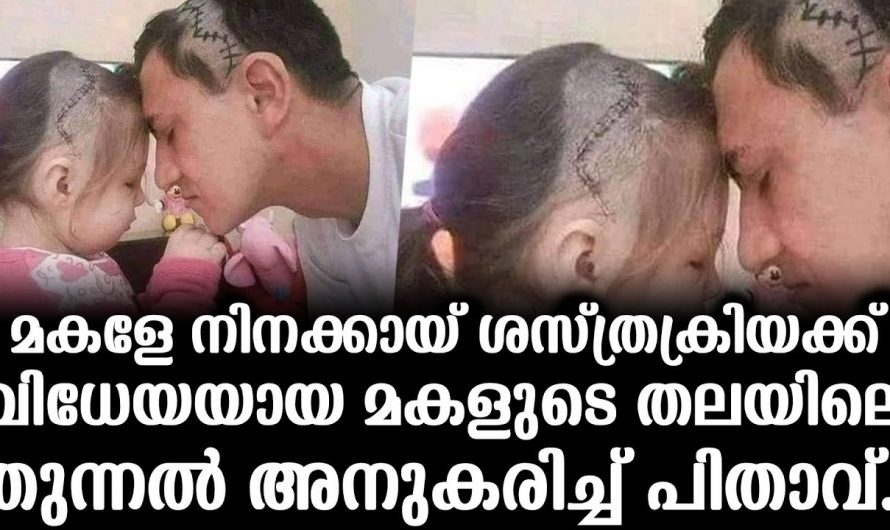 ഈ അച്ഛന്റെ സ്നേഹത്തിന് പകരം വയ്ക്കാൻ ലോകത്ത് മറ്റൊന്നും തന്നെ ഇല്ല. വേദനിക്കുന്ന മകളെ കണ്ട് അച്ഛൻ ചെയ്തത് കണ്ടോ.