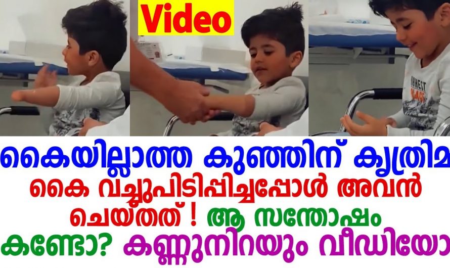 കണ്ണ് നിറഞ്ഞ ഡോക്ടർമാർ  കൈകളില്ലാതെ ജനിച്ച കുഞ്ഞിനെ കൈകൾ കൊടുത്തപ്പോൾ അവന്റെ സന്തോഷം കണ്ടോ.