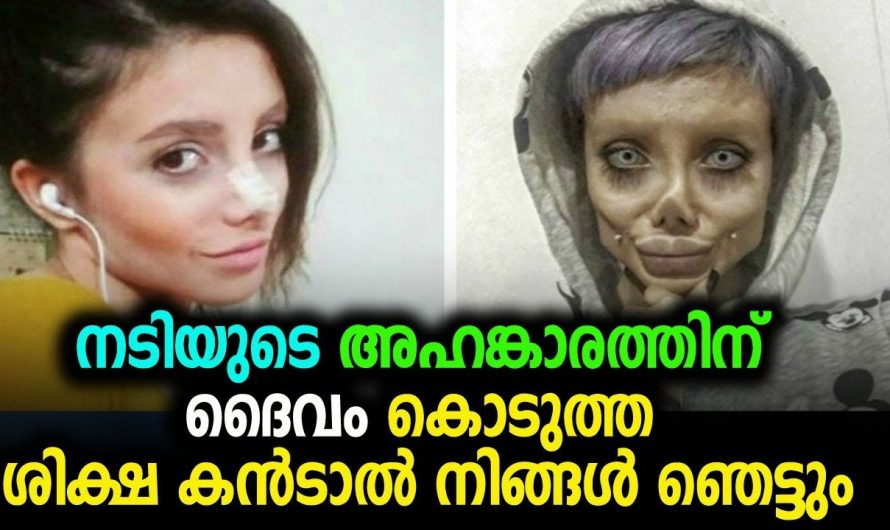 സിനിമാനടിയെ പോലെ ആകണമെന്ന് കരുതി ചെയ്തതാ. 19 കാരിക്ക് സംഭവിച്ചത് കണ്ടാൽ നിങ്ങൾ ഞെട്ടും.